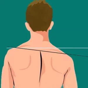 پکیج تمرینات شانه افتاده