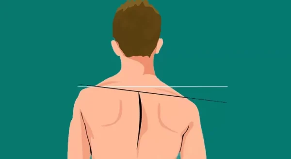 پکیج تمرینات شانه افتاده