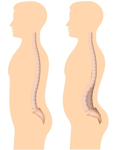 پکیج تمرینات رفع گودی کمر