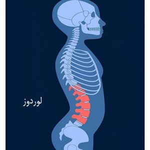 تمرینات کمک به رفع گودی کمر (لوردوز)- سری 2